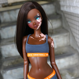 Smart Doll - Legion vitiligo